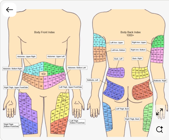 Numbered insulin injection rotation map for the abdomen, upper arms, buttocks and thighs